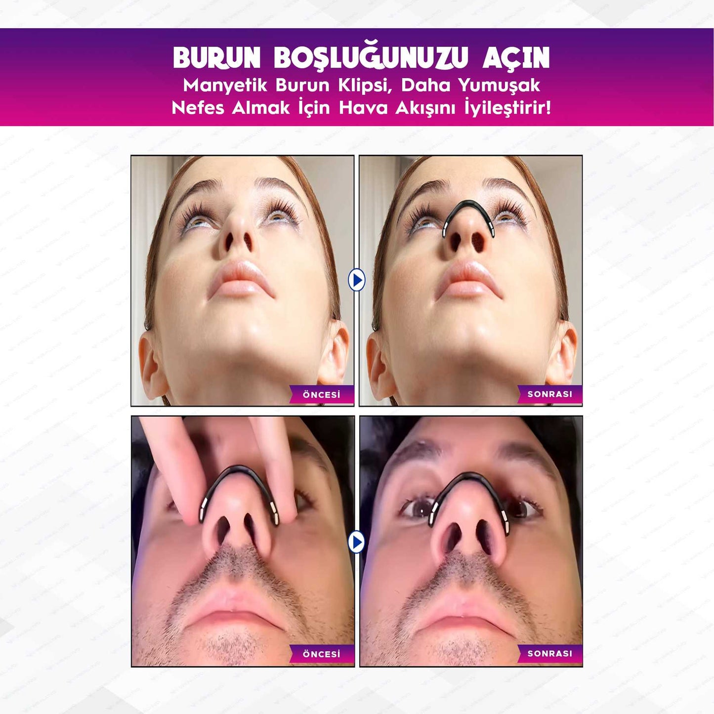 Mıknatıslı Premium Burun Bandı Seti