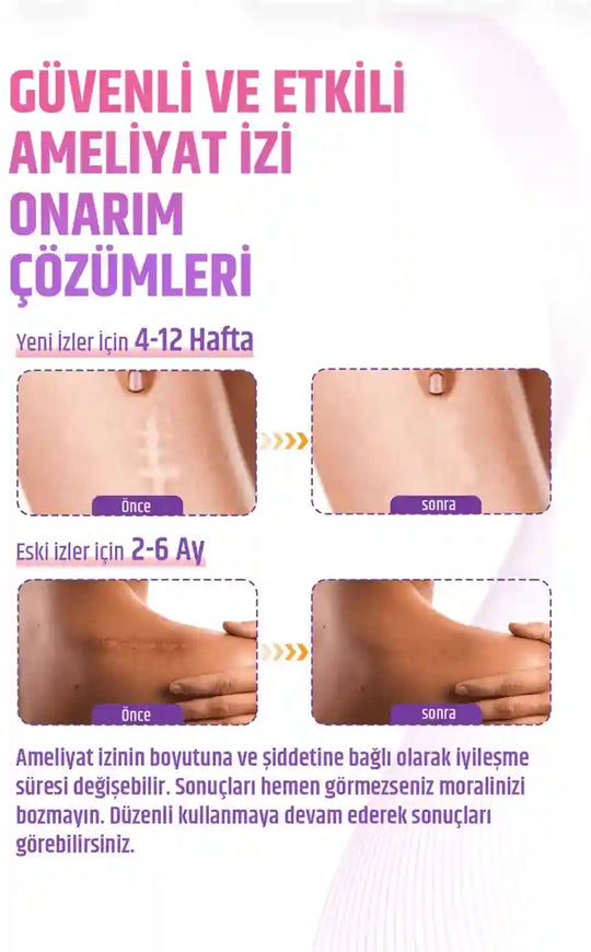 yanik ameliyat keloid izleri